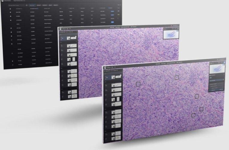 مایکروسافت بزرگ‌ترین مدل هوش مصنوعی تشخیص سرطان را می‌سازد