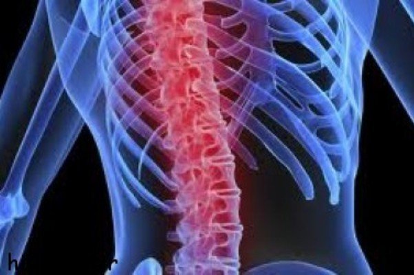 آسیب نخاعی باعث تحلیل رفتن عضلات می شود - خبرگزاری مهر | اخبار ایران و جهان