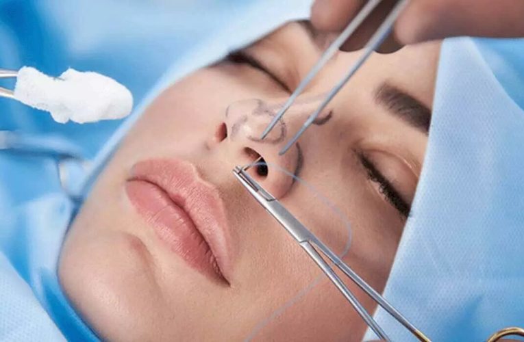 افزایش تقاضا برای جراحی زیبایی صورت – خبرگزاری مهر | اخبار ایران و جهان_تاشکن