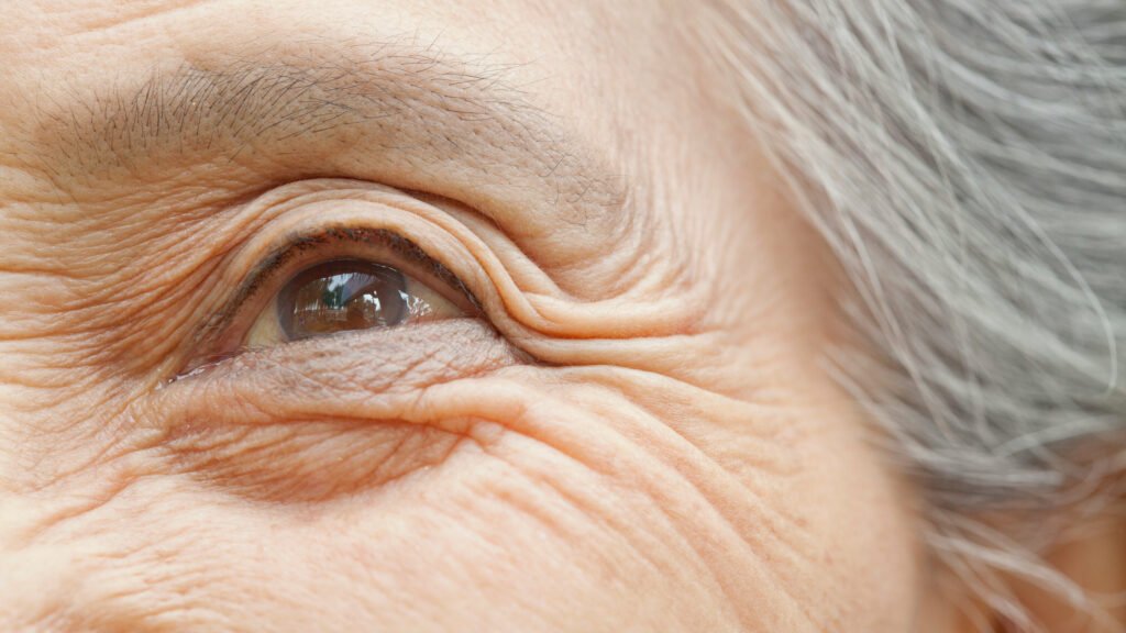 روند چشمگیر پیری 