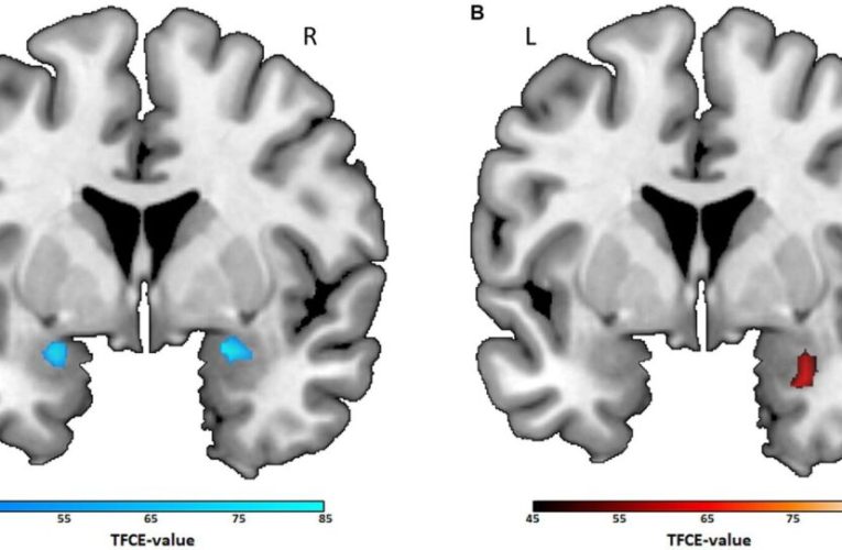 ژانر فیلم مورد علاقه شما چه اسراری از مغزتان آشکار می‌کند؟_تاشکن