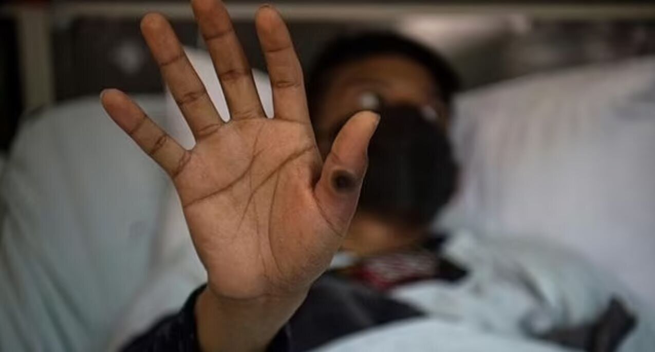 آبله میمونی یک تهدید جدی است/ اهمیت اقدامات پیشگیرانه - خبرگزاری مهر | اخبار ایران و جهان