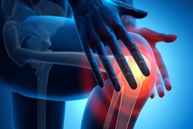 پوکی استخوان؛ بیماری خاموش/ آغاز پویش همگانی از امروز - خبرگزاری مهر | اخبار ایران و جهان