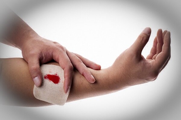 یازدهمین کنگره بین‌المللی زخم و ترمیم بافت برگزار می‌شود - خبرگزاری مهر | اخبار ایران و جهان