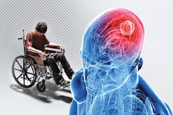 ۱۲۰ هزار بیمار «ام‌اس» در کشور؛ بیمه کدام خدمات را پوشش می‌دهد؟ - خبرگزاری مهر | اخبار ایران و جهان