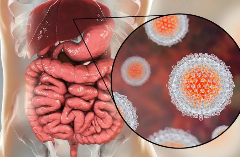شیوع هپاتیت A در جمهوری چک جان ۱۰ نفر را گرفت – خبرگزاری مهر | اخبار ایران و جهان_تاشکن