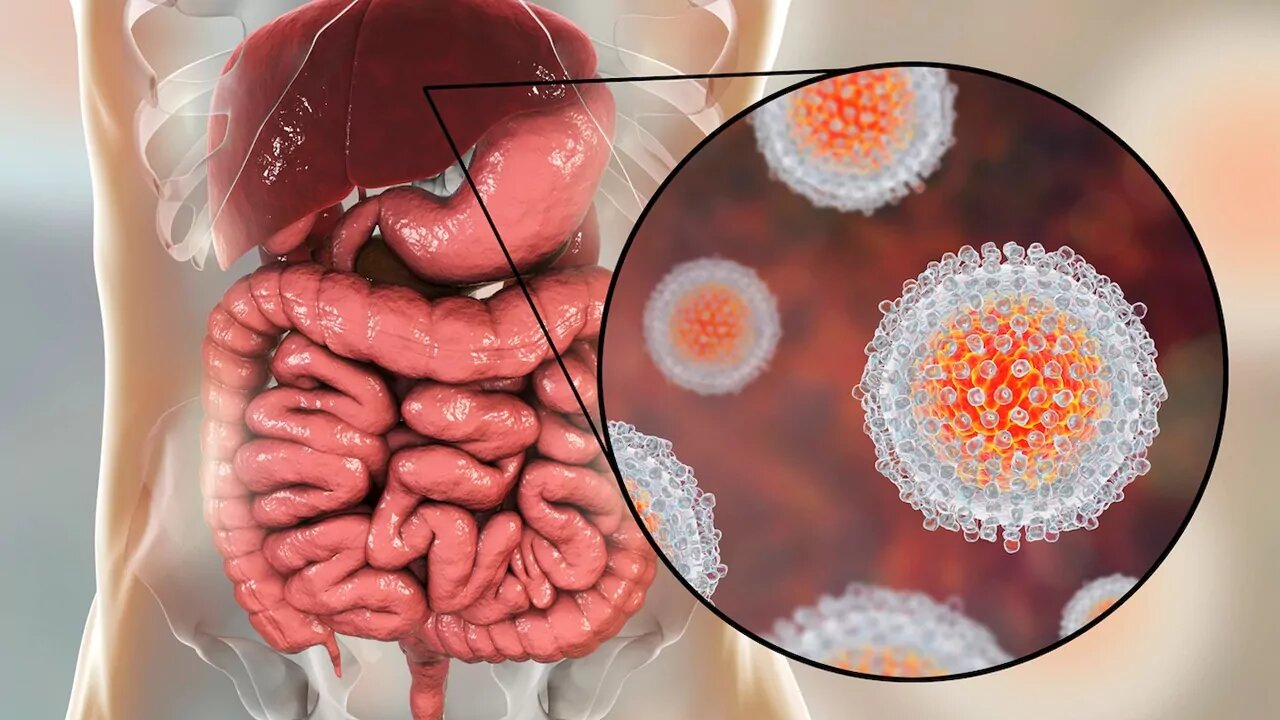 شیوع هپاتیت A در جمهوری چک جان ۱۰ نفر را گرفت - خبرگزاری مهر | اخبار ایران و جهان